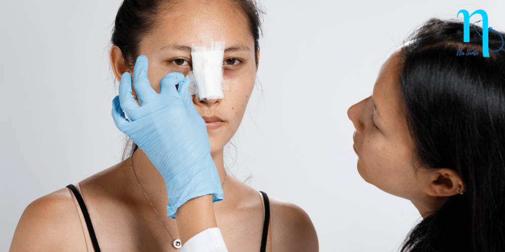 rhinoplastie pansement